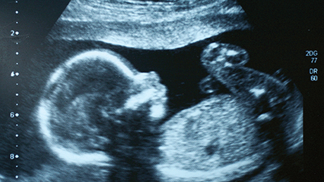 ultrasound
