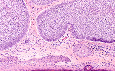 Skin cells under a microscope (c) UC Regents. All rights reserved.