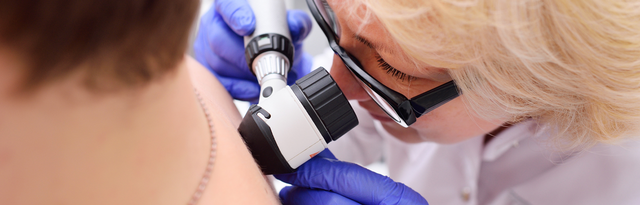 Dermatologist inspects a patient's skin (c) UC Regents. All rights reserved.