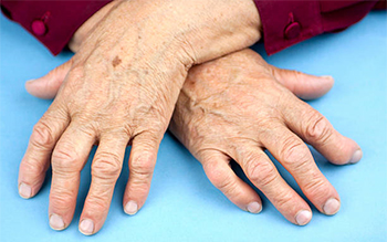 two hands crossed