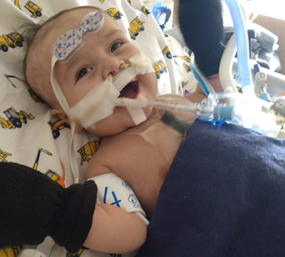 Baby patient after surgery
