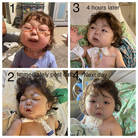 Before and after photos of Zyllah