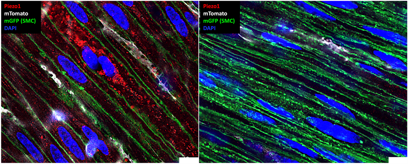 Piezo1 mechanosensor in smooth muscle cell