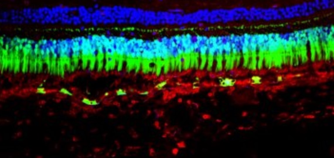 Fluorescent images of individual cells in the retina. 