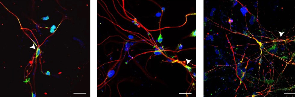 chromosome activation