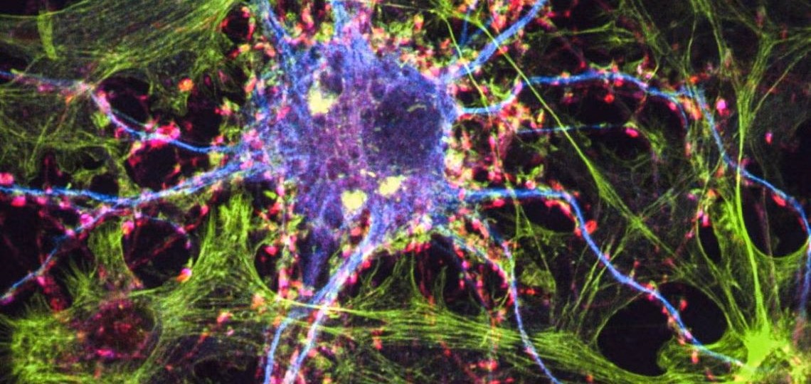 Colored image of nerve cells. 