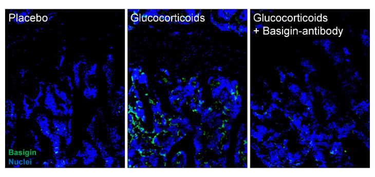 Images of Basigin in bone/bone marrow of mice treated with Placebo, Glucocorticoids or Glucocorticoids and Basigin Antibody.