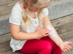girl applying lotion