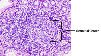 Lymphoid follicle