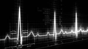 Electrocardiogram