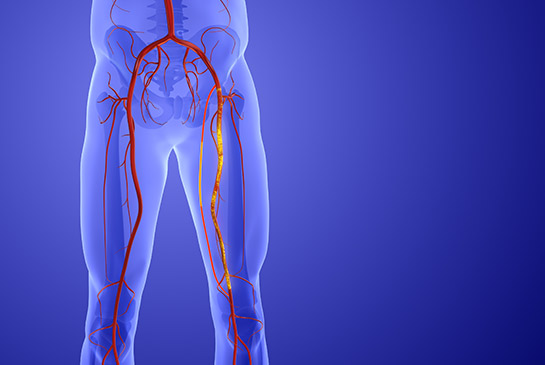 Vascular stock