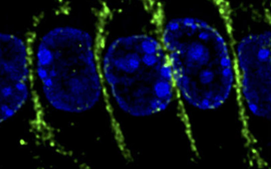 Microscope with cells