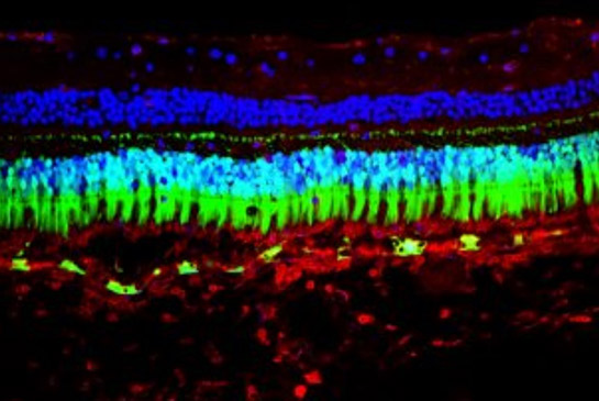 Eye imaging