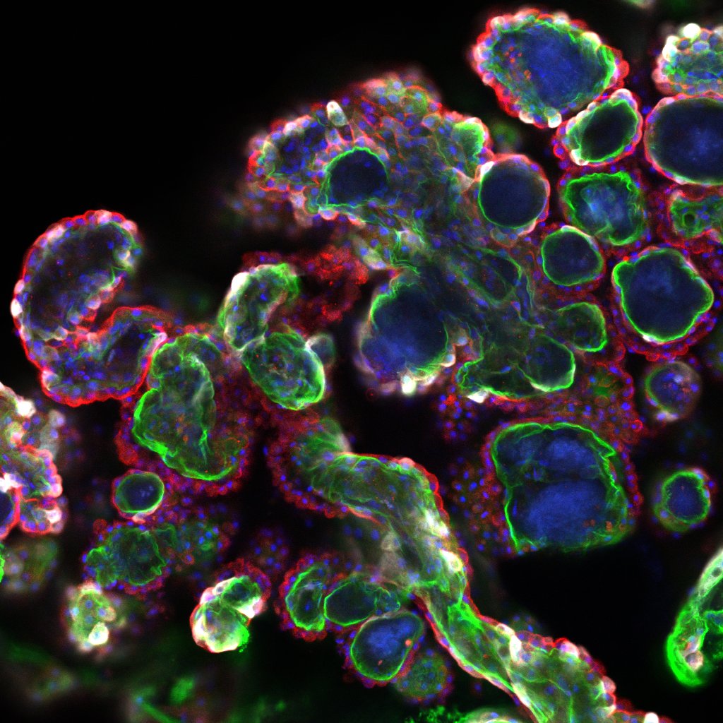 Microscopy image of specialized cells in the brain being treated with gene therapy