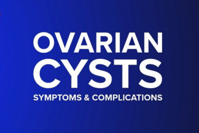 Video thumbnail reads "Ovarian Cysts."
