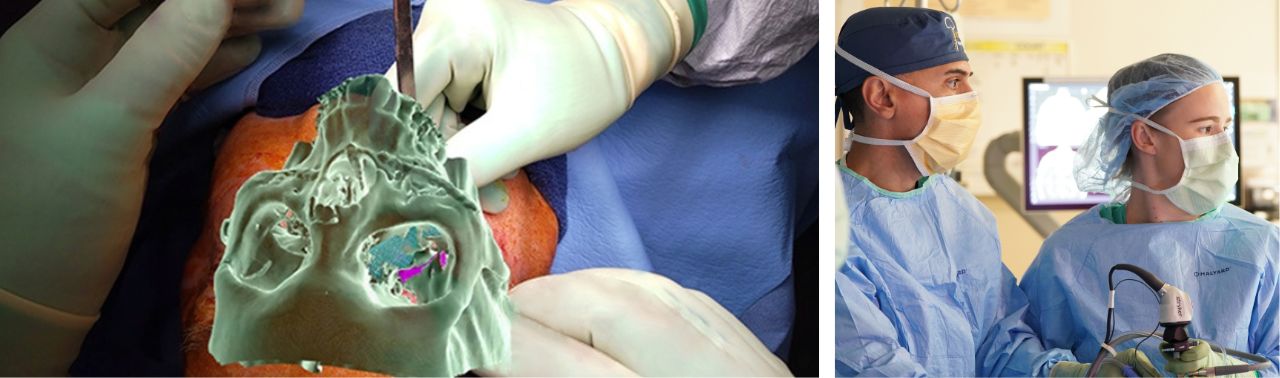 surgeon and resident working on a skull base case using virtual reality