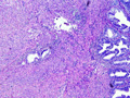 Microscopic photographs 6