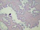 Microscopic image 1: Ovary (Click to enlarge)