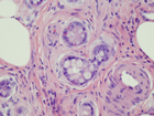 Microscopic image 7: Appendix (Click to enlarge)