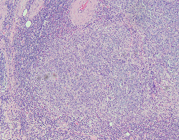 Figure 2. H&E 10x