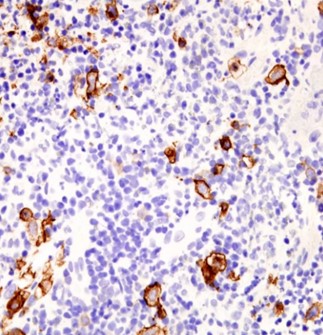 CD30