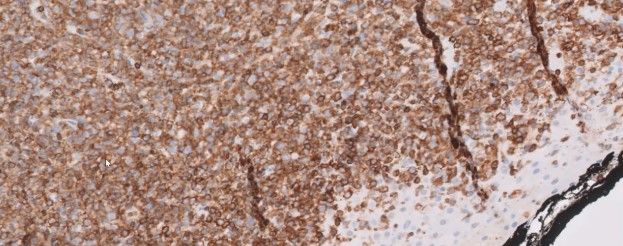 CD45