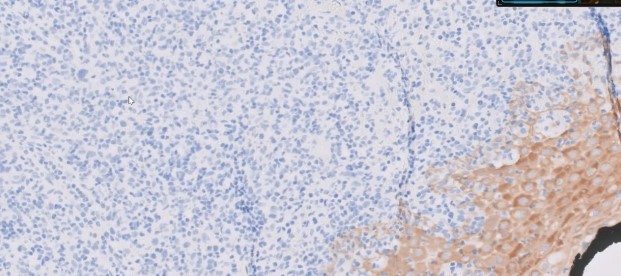 Hematolymphoid cells
