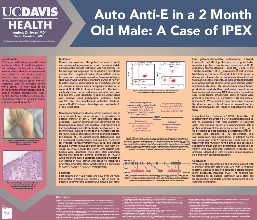 Jones Andrew AABB poster