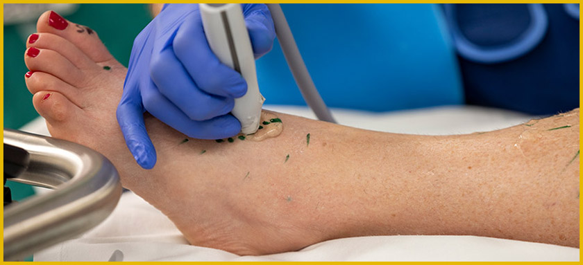 Foot ultrasound