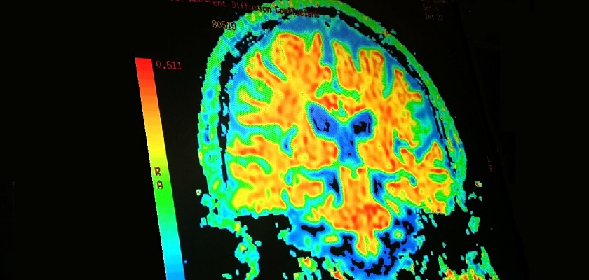 MY MRI UC Davis Health