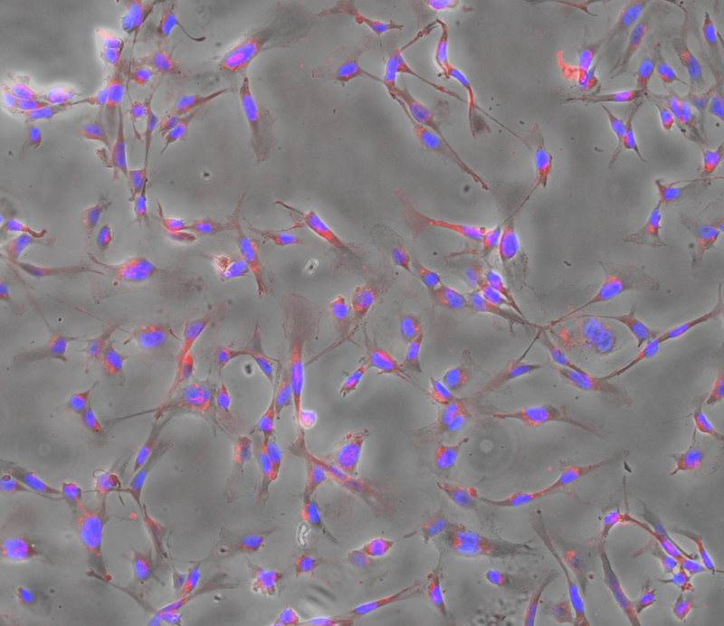 Exosome_therapeutics