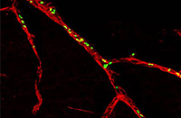 Macular Degeneration