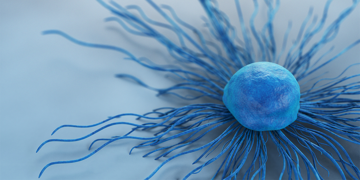 ovarian cancer