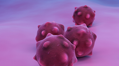 Pancreatic cancer