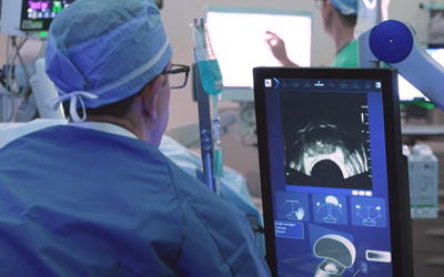 Focal Therapy for Prostate Cancer: HIFU Robotic Treatment Explained