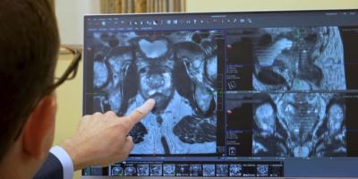 Doctor pointing at prostate scan (c) UC Regents. All rights reserved.